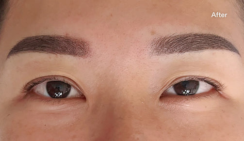 after