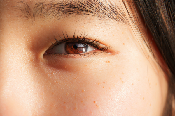 woman gets lash serum applied 